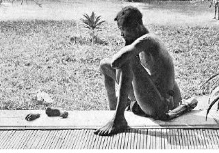 Nsala of Wala in Congo looks at the severed hand and foot of his five-year-old d...